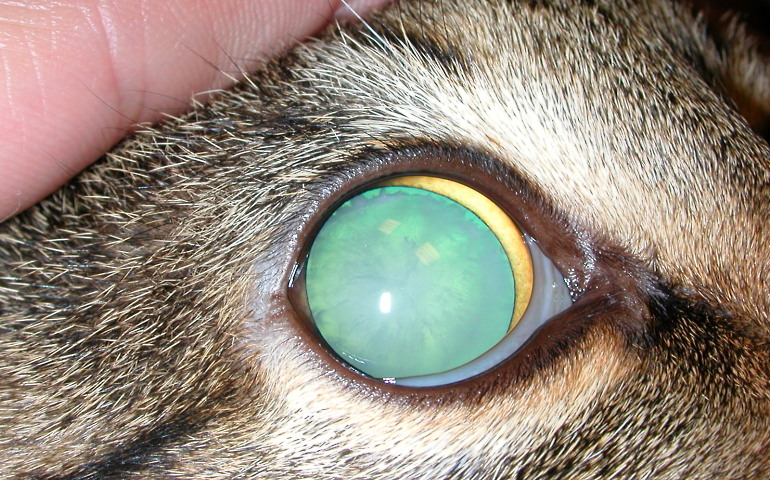 Что такое хрусталик и что такое катаракта